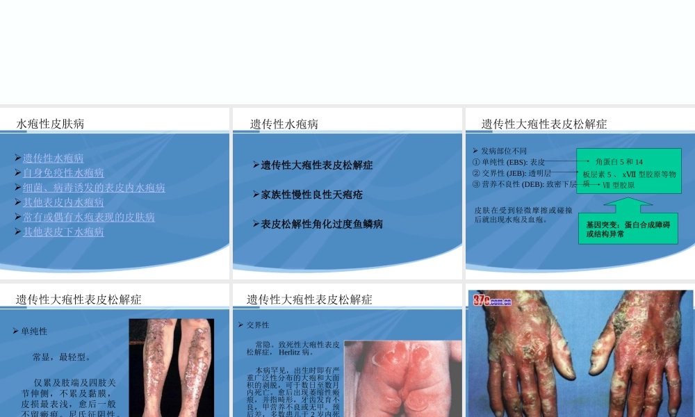 水疱性皮肤病.ppt