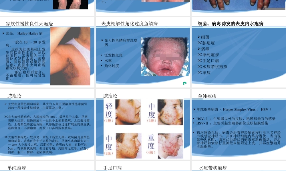 水疱性皮肤病.ppt
