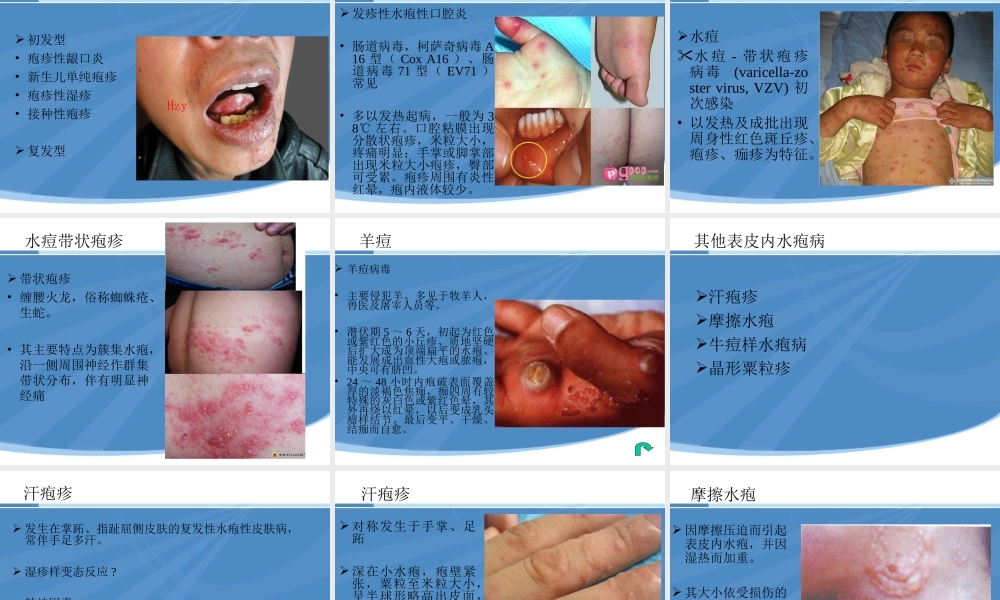 水疱性皮肤病.ppt