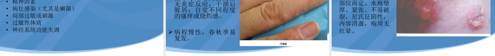 水疱性皮肤病.ppt