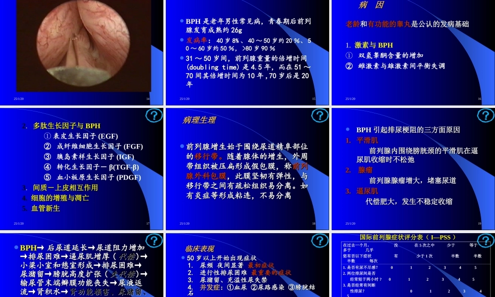 泌尿系统梗阻.ppt