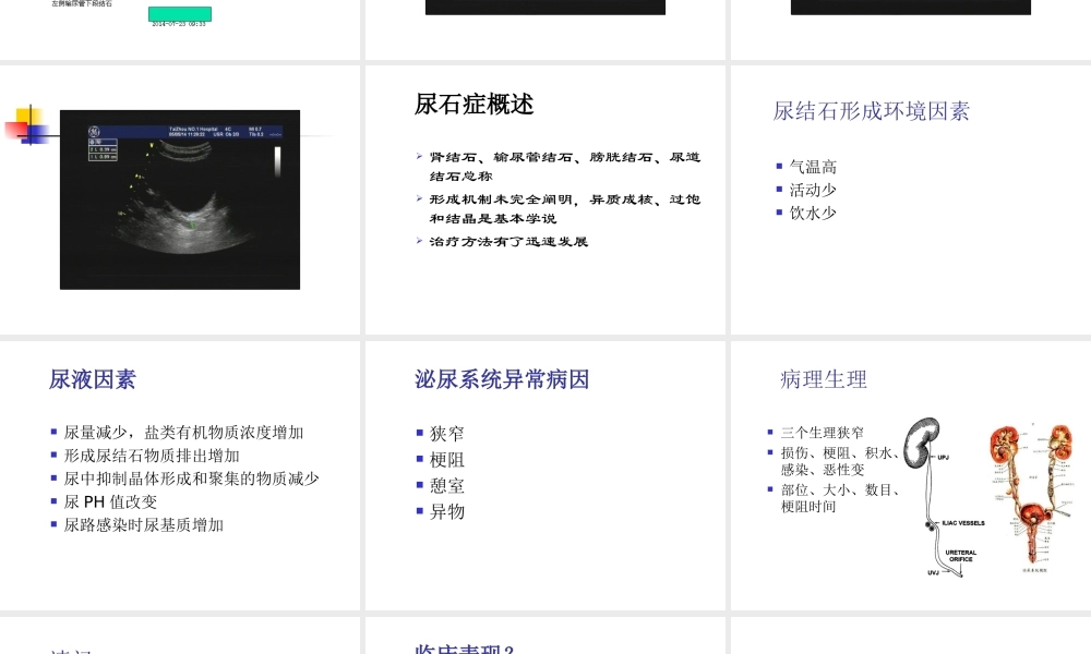 教学查房输尿管结石.ppt
