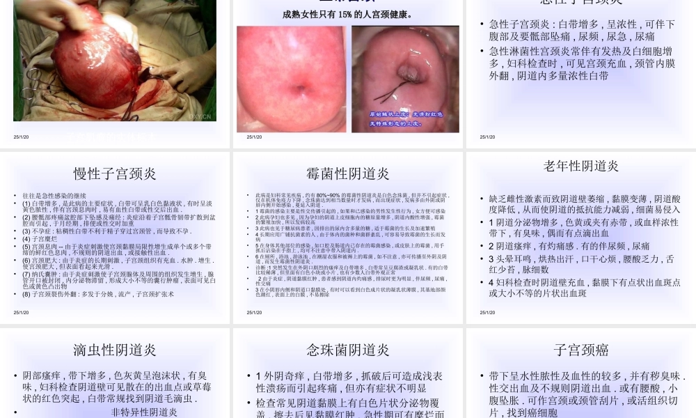 最新整理女性生殖健康讲座.ppt