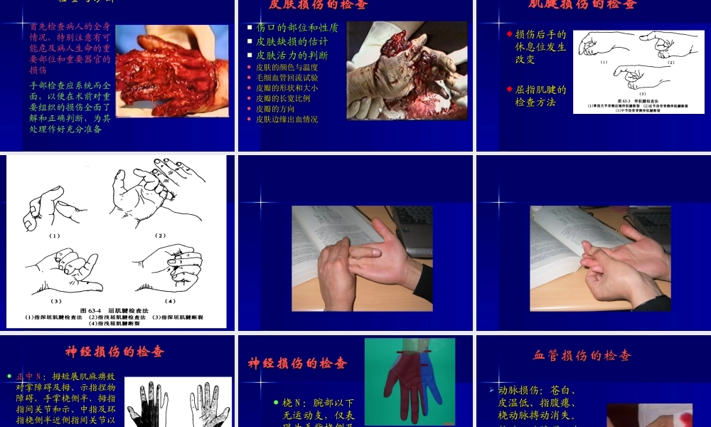 手外伤及断肢(指)再植(讲稿).ppt