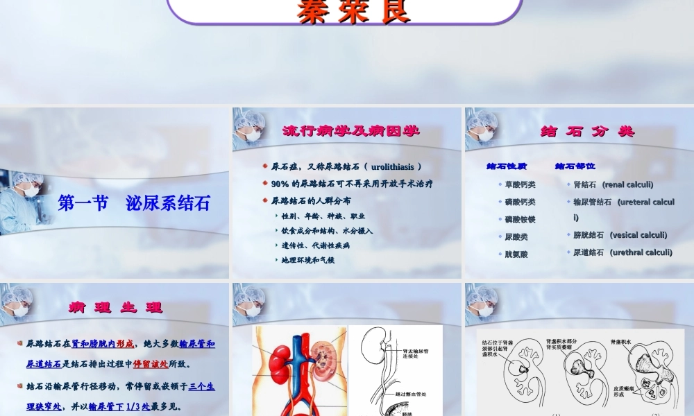 泌尿系结石与感染-秦教授.ppt