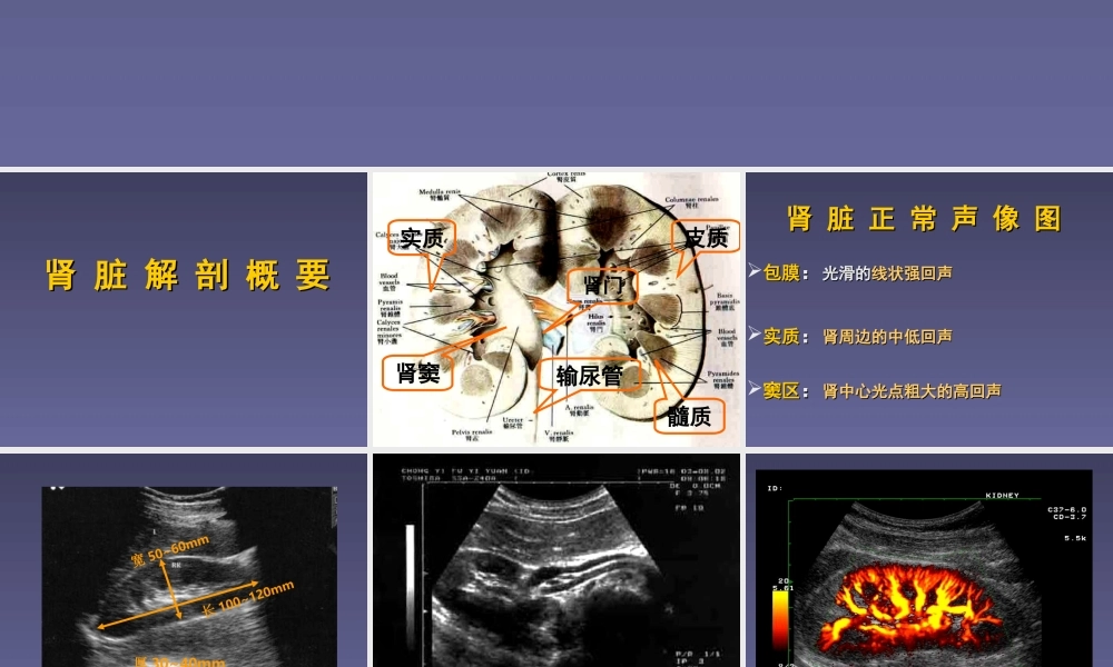 泌尿系统超声检查.ppt