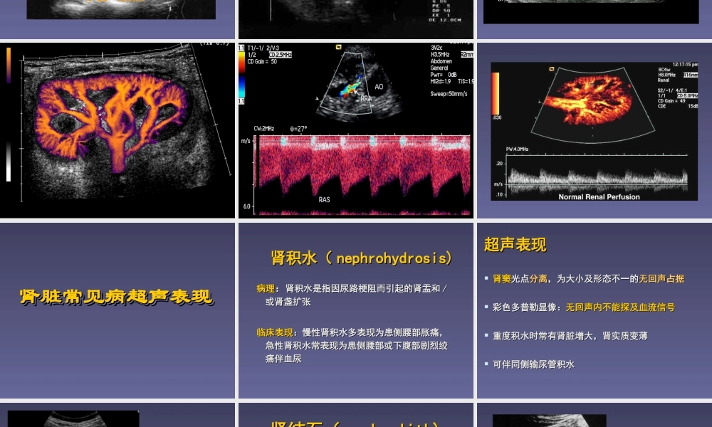 泌尿系统超声检查.ppt