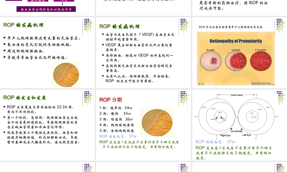 早产儿视网膜病.ppt