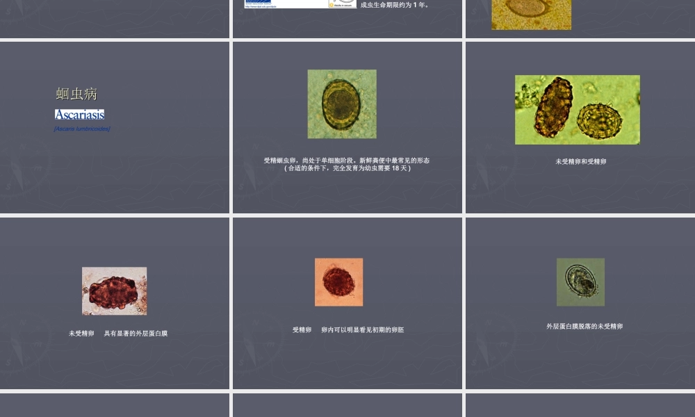 最常见肠道寄生虫.ppt