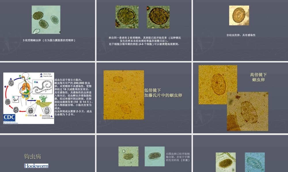 最常见肠道寄生虫.ppt