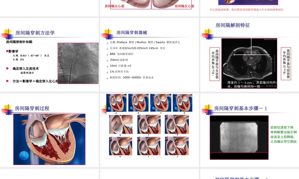房间隔穿刺术李述峰-.ppt