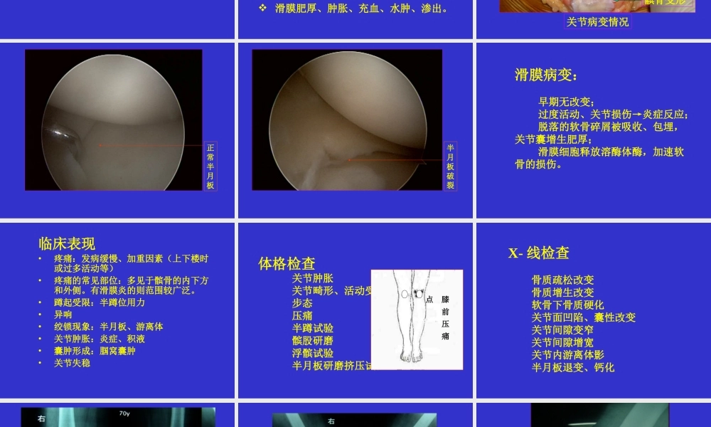 朝鲁门-老年性骨关节病.ppt