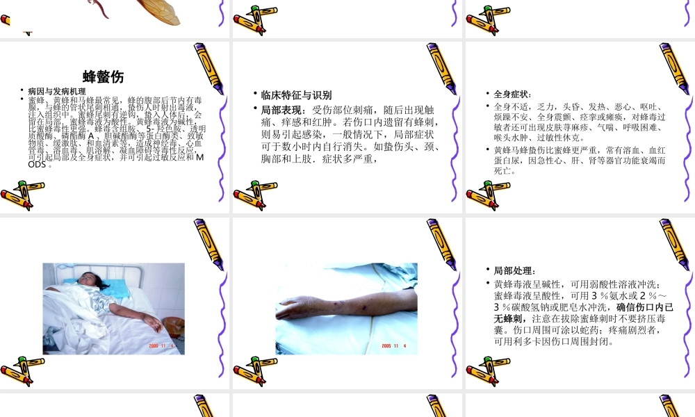 毒虫咬伤的救治.ppt
