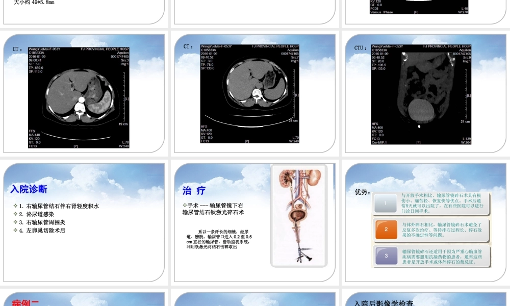 泌尿外科病例分享.ppt