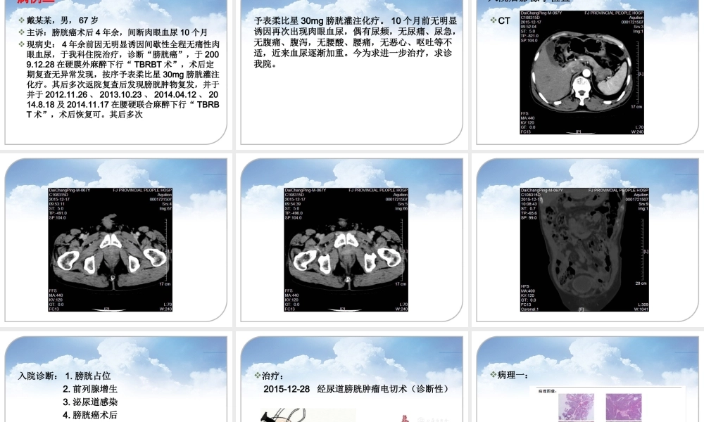 泌尿外科病例分享.ppt