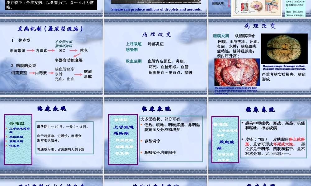 流行性脑脊髓膜炎知识要点.ppt