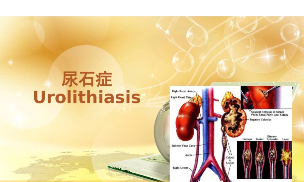 泌尿系结石.ppt