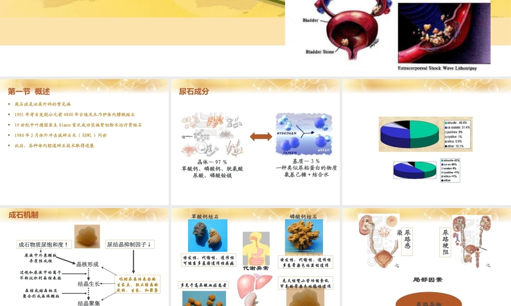 泌尿系结石.ppt