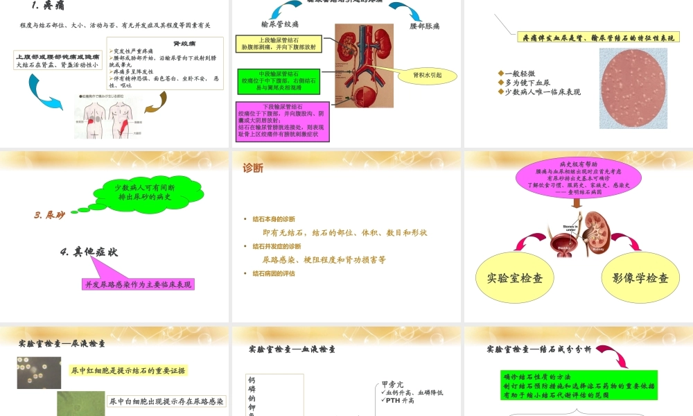 泌尿系结石.ppt
