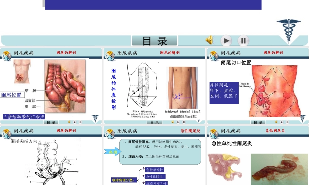 急性阑尾炎.PPT.ppt