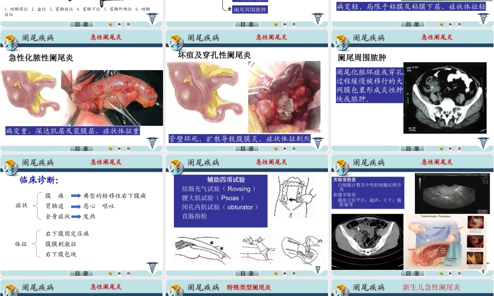 急性阑尾炎.PPT.ppt