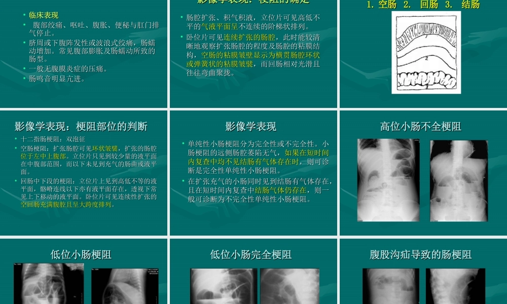 急腹症+腹膜后疾患.ppt