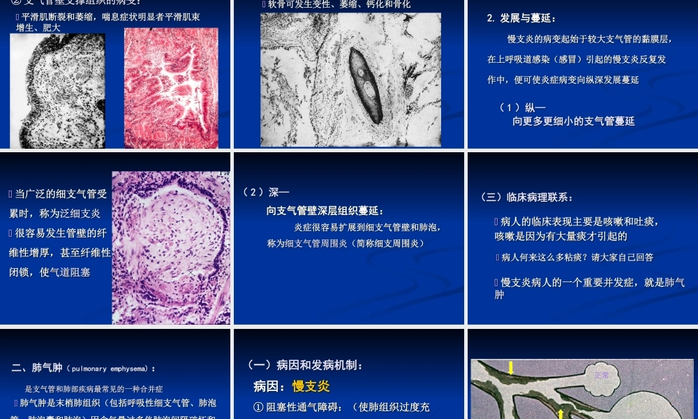 慢支炎肺气肿肺心病.ppt