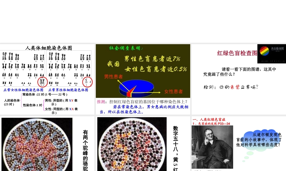 抗维生素D佝偻病是伴X显性遗传病.ppt
