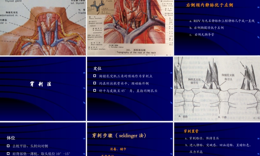 最新深静脉穿刺置管术.ppt