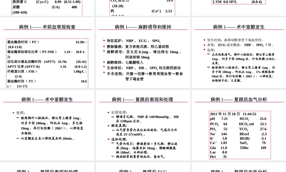 术中室颤的发生与处理.ppt