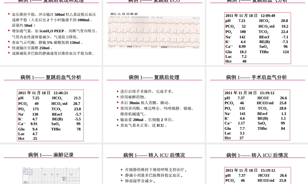 术中室颤的发生与处理.ppt