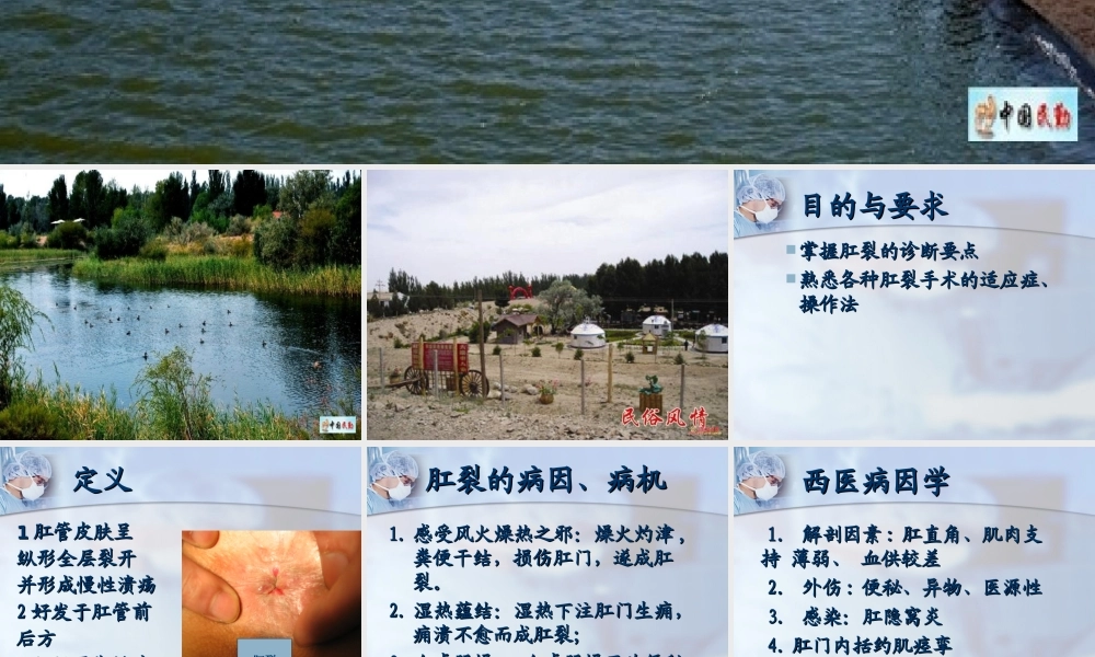 民勤协和医院-肛裂.ppt