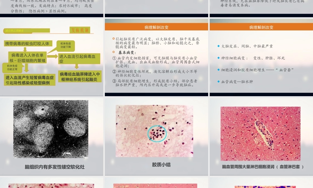 流行性乙型脑炎1.pptx