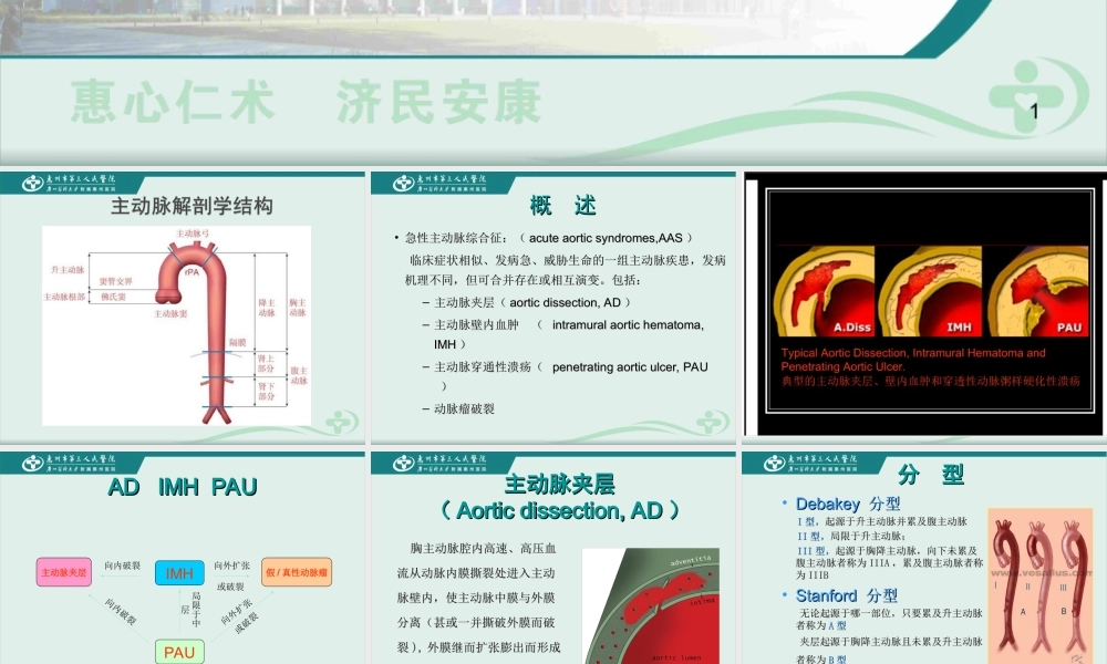 急性主动脉综合征的诊疗进展.ppt