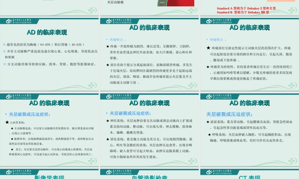 急性主动脉综合征的诊疗进展.ppt