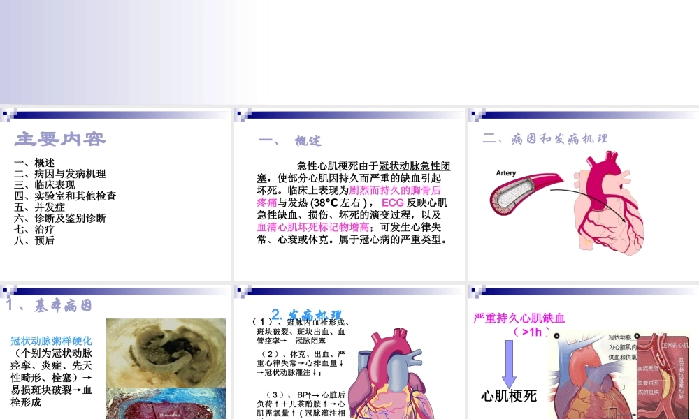 急性心肌梗死.ppt