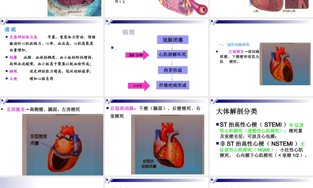 急性心肌梗死.ppt