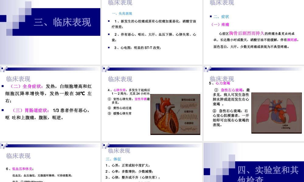 急性心肌梗死.ppt