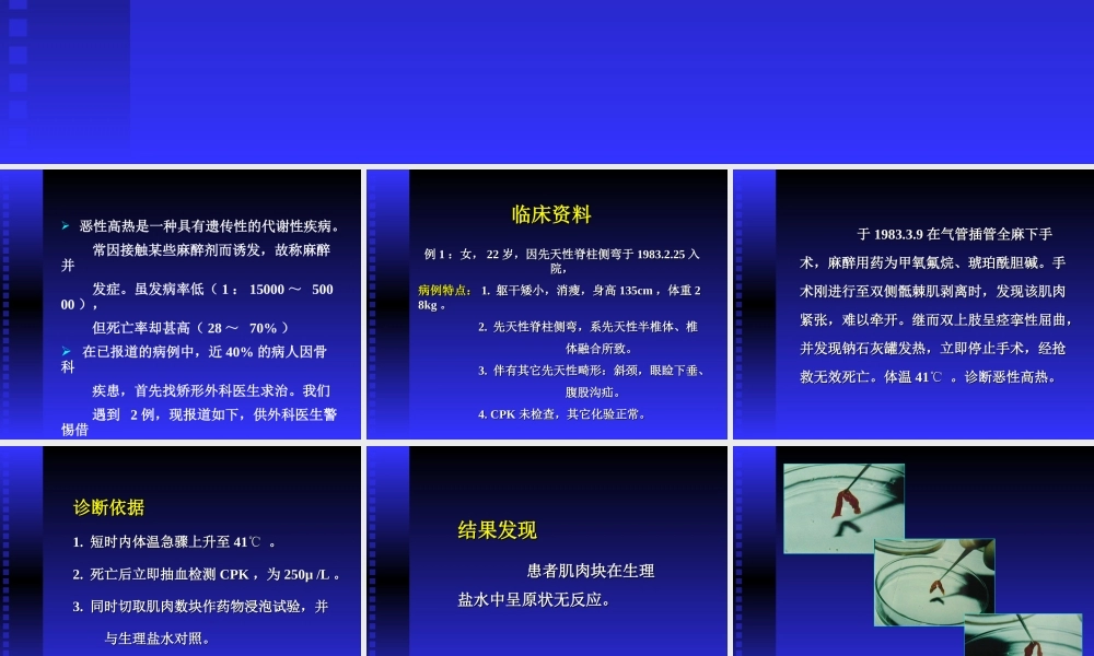 恶性高热的术前预测及其防治.ppt