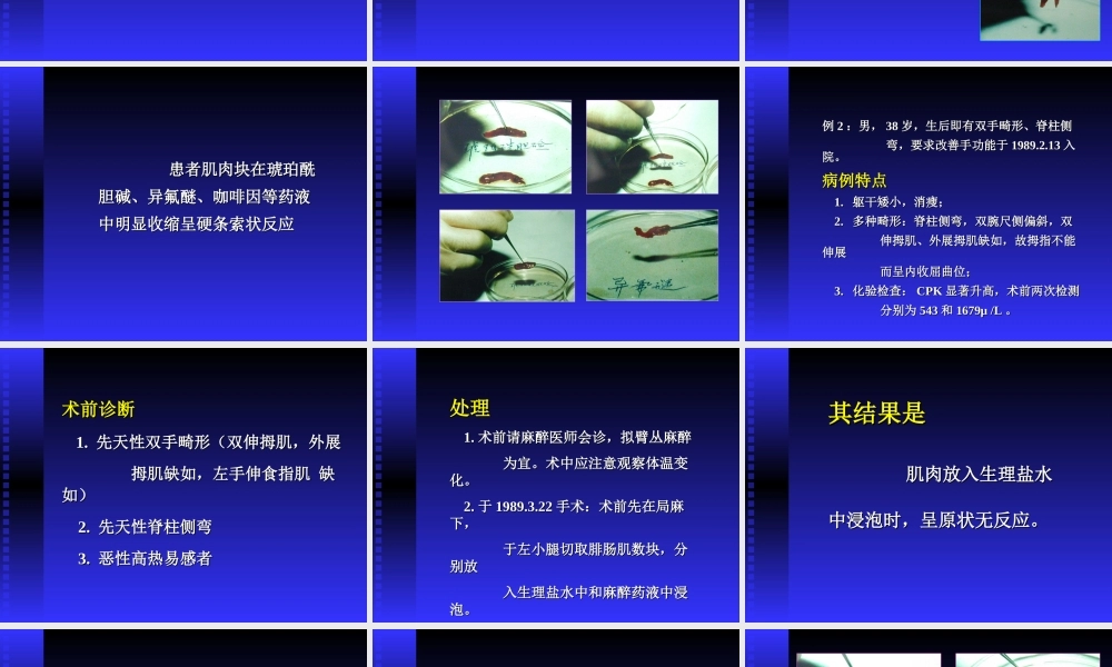 恶性高热的术前预测及其防治.ppt