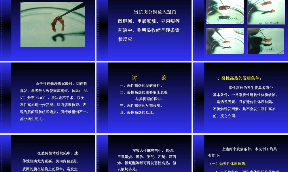 恶性高热的术前预测及其防治.ppt