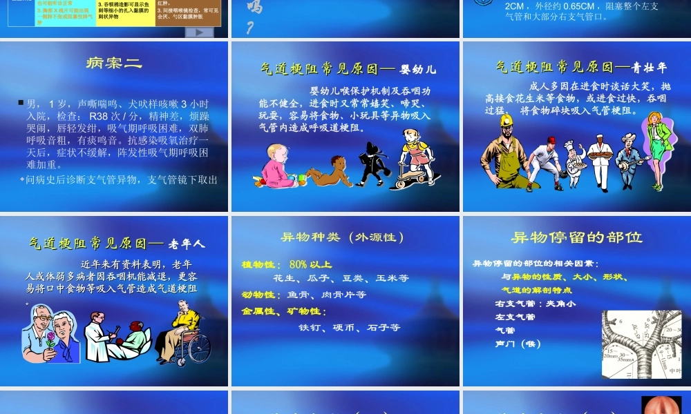 急性呼吸道梗阻.ppt