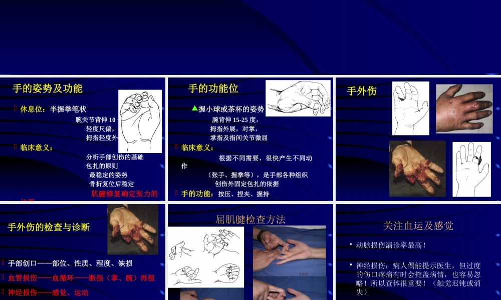 手外伤诊治与康复1.pptx