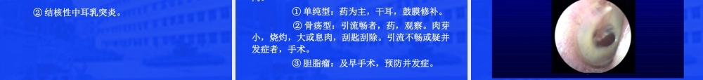 急慢性化脓性中耳炎.ppt
