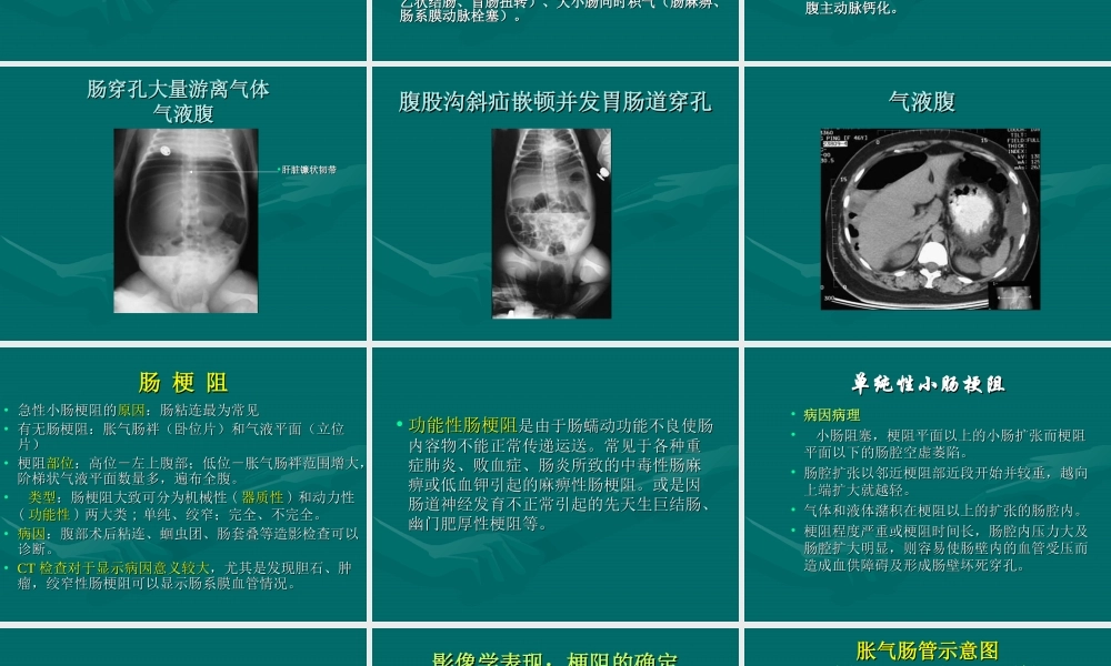 急腹症-影像FTP.ppt