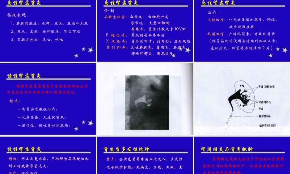 泌尿、生殖系统感染.ppt