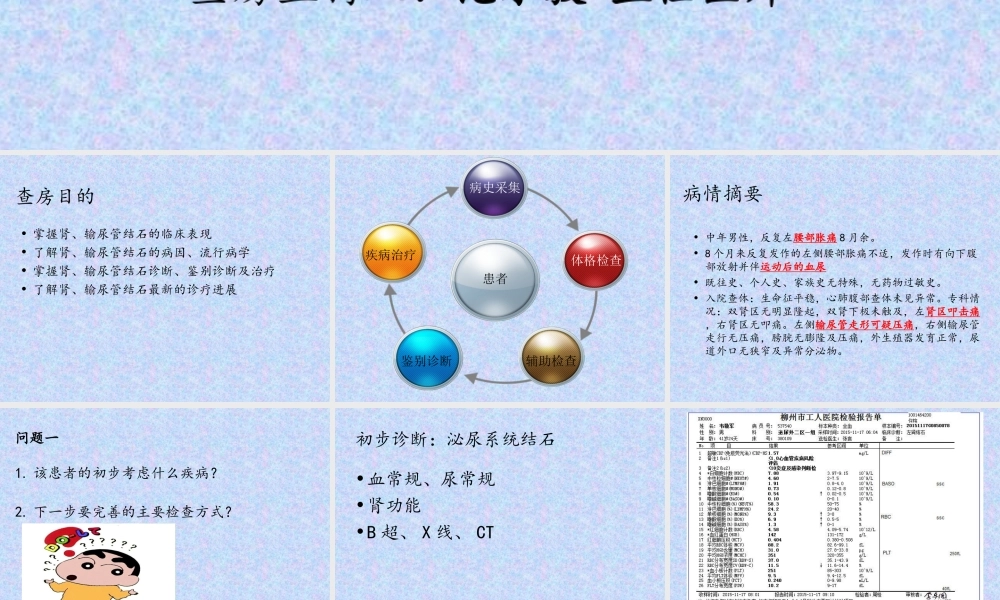 泌尿外科结石教学查房.ppt