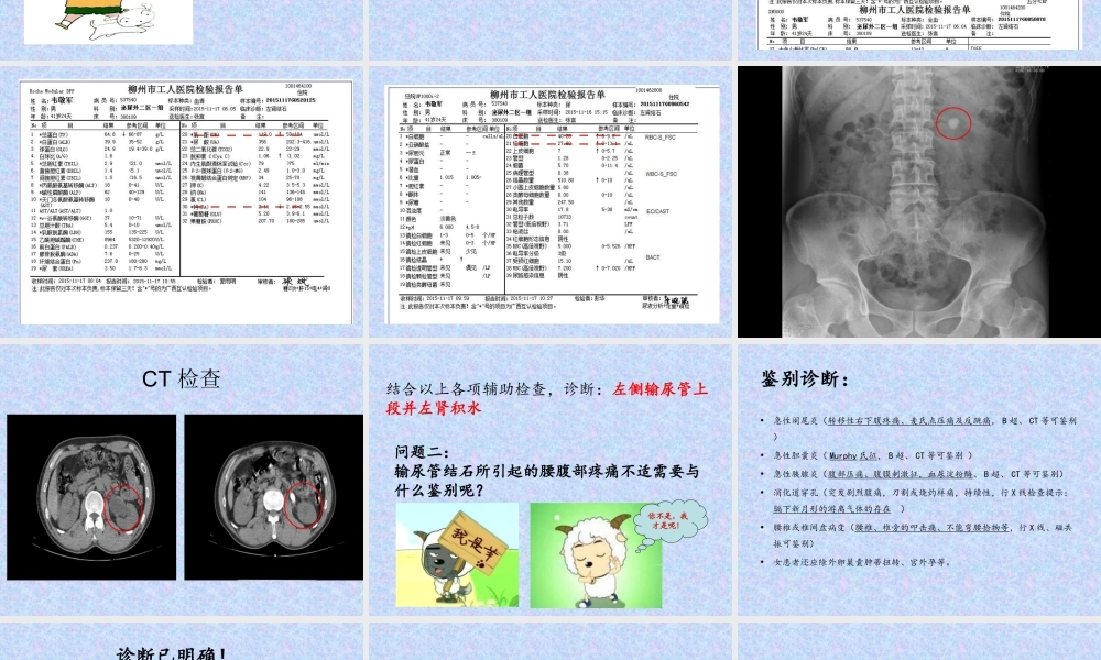 泌尿外科结石教学查房.ppt