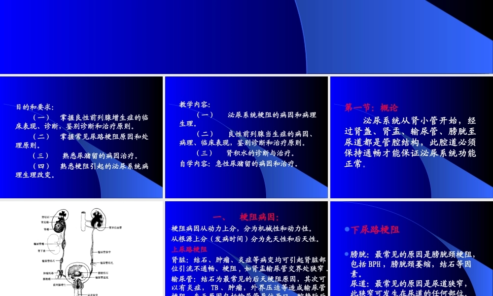 泌尿系梗阻.ppt