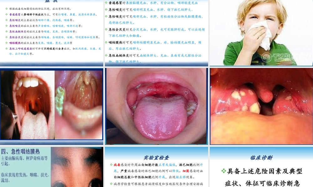 急性上呼吸道感染吴慧毅(最终版).pptx